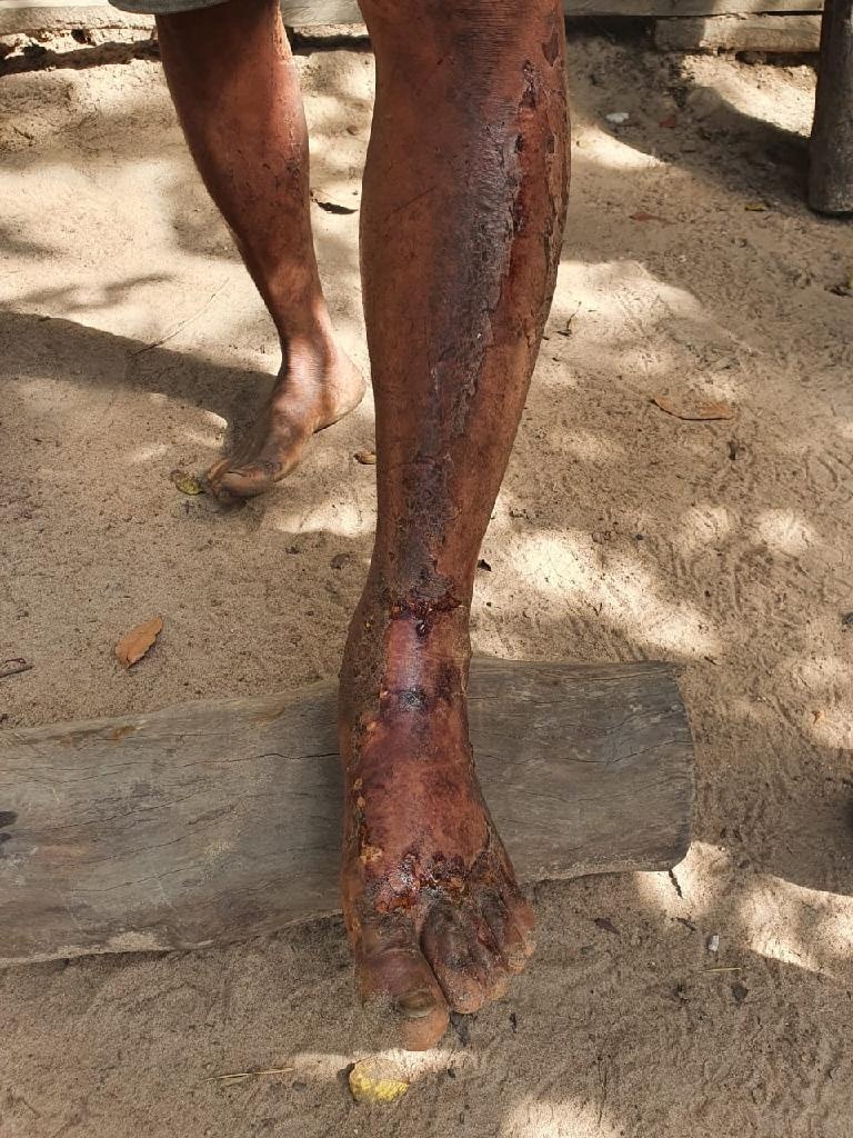 Suspeito é preso pela PM por atirar em colega de trabalho e colocar fogo na residência da vítima